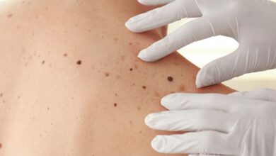 200 Dermatologic Disease 