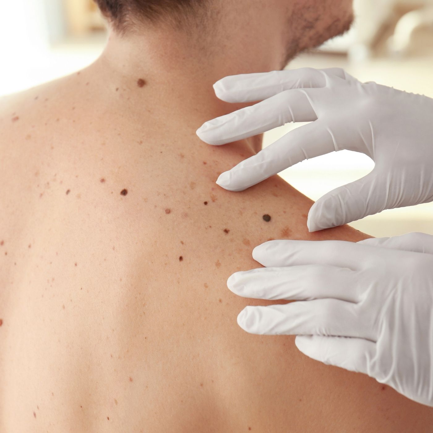 200 Dermatologic Disease 